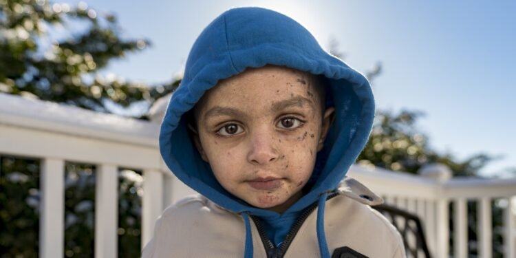 A 4-year-old Gaza boy lost his arm – and his family. Half a world away, he’s getting a second chance