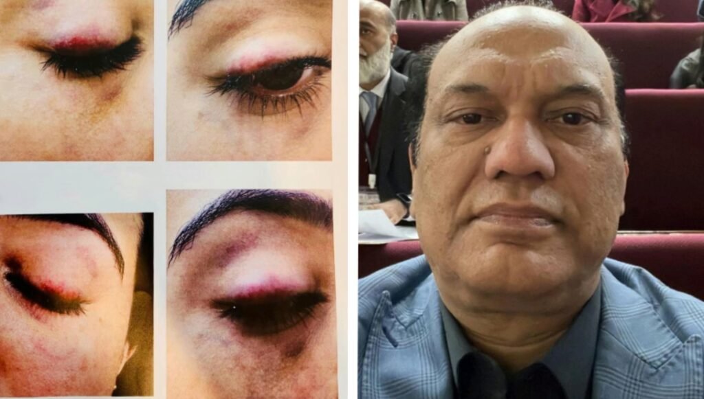 Case filed against vice chancellor of Health Services Academy Islamabad for alleged assault on female