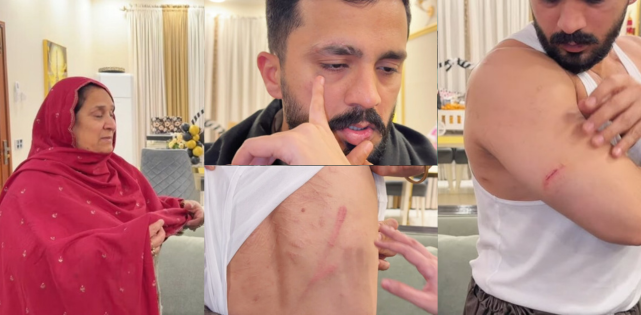 Rajab Butt Beaten, Mother Reacts Strongly for Attack, Showing Emotional Anger and Concern